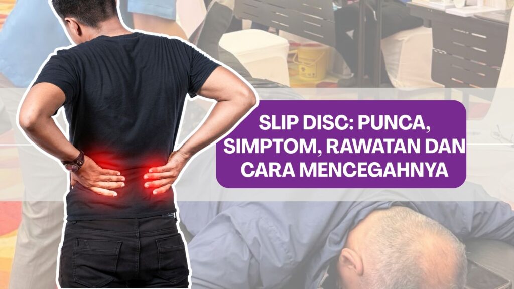 Slip Disc: Punca, Simptom, Rawatan dan Cara Mencegahnya
